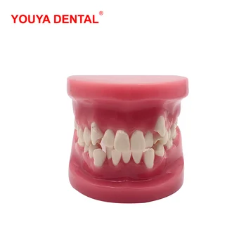3D Sveķu Zobu Modeli Zobiem Malocclusion Modeli Par Demostration Mācību Zobārsts Studentiem Studiju Orālās Medicīnas Zobārstniecības Produkti
